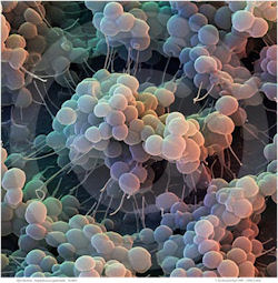 bacteriasdaysarenumbered.jpg