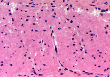 musclecells.jpg